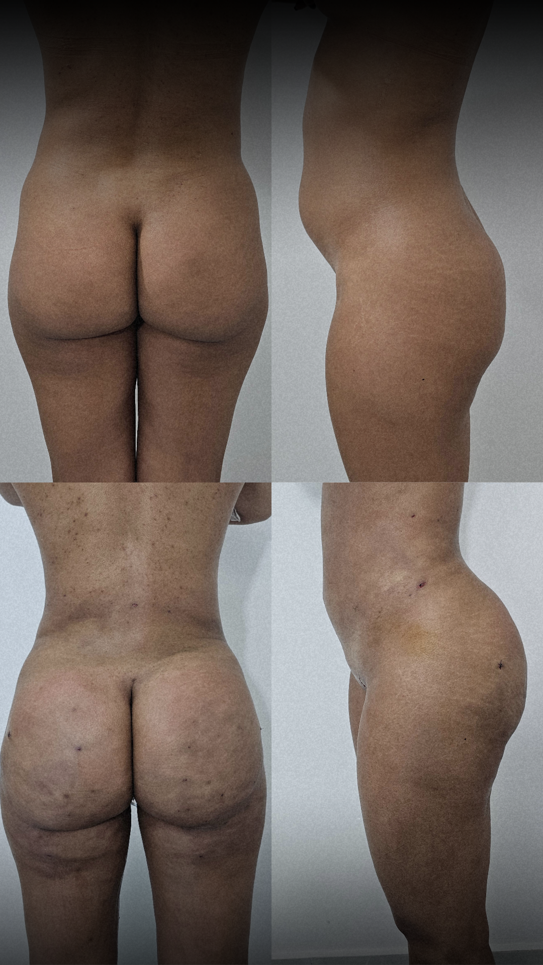 ANTES E DEPOIS 2 _ PACIENTE