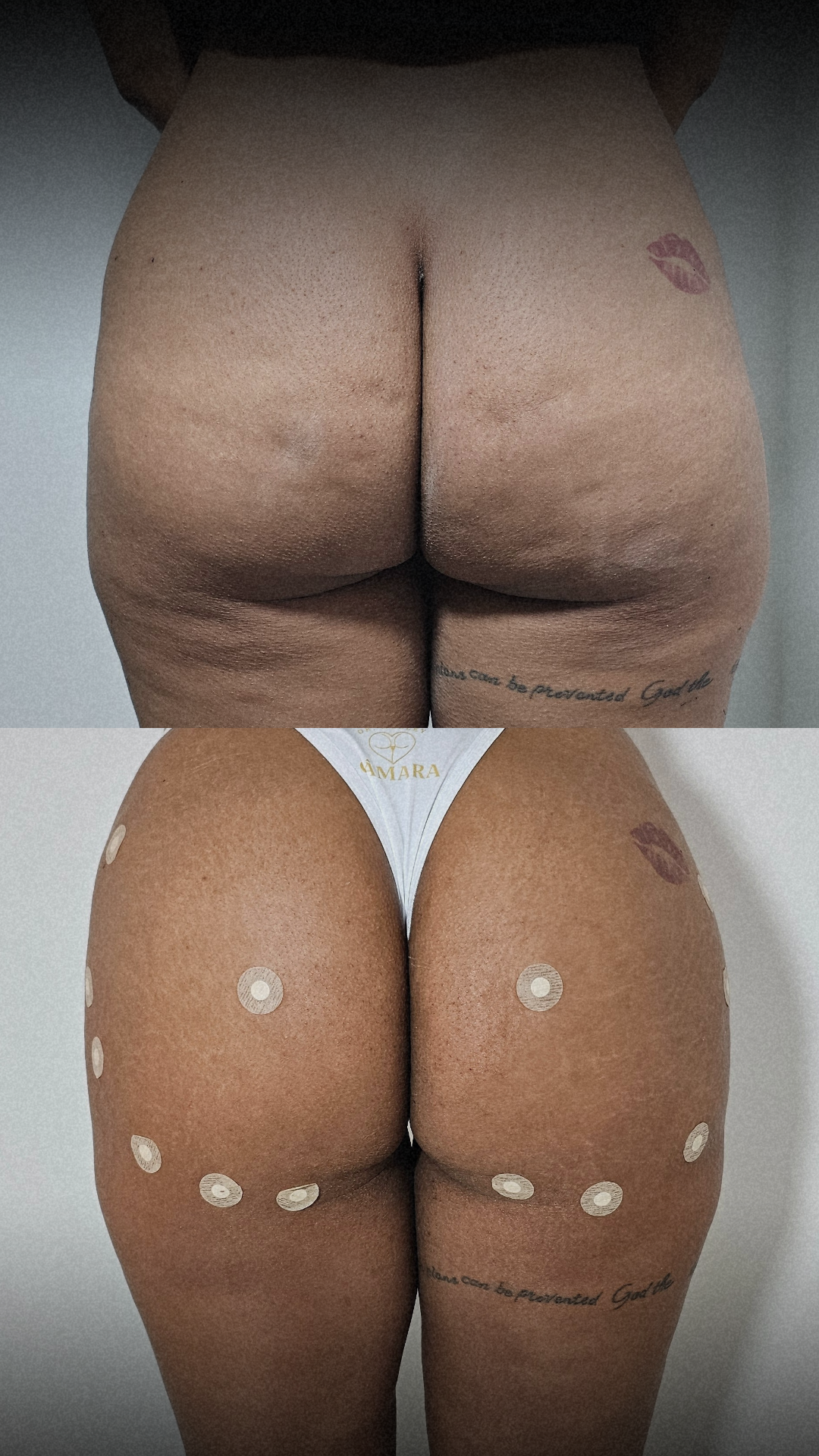 ANTES E DEPOIS _ PACIENTE
